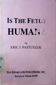 IS THE FETUS HUMAN?
